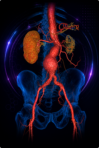 Abdominal Aorta 3D Reconstruction