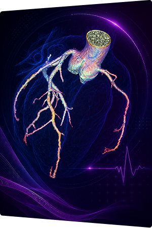 Coronary CT Angiography