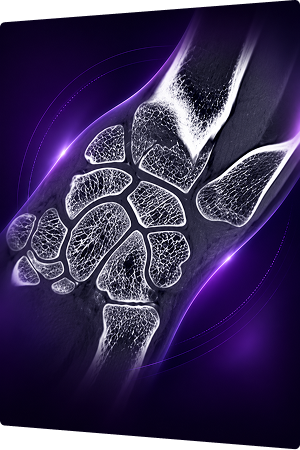 Wrist — Fine Bone Detail